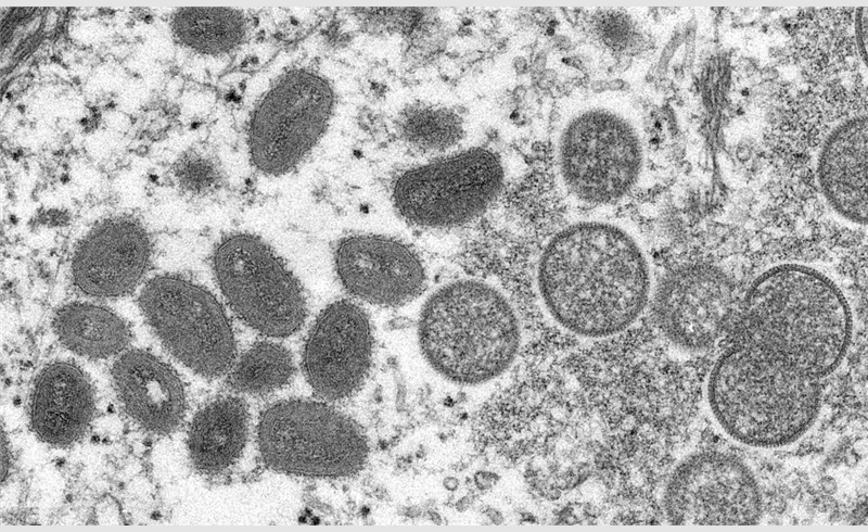 Secretaria Estadual da Saúde confirma primeiro caso da varíola do macaco no Rio Grande do Sul